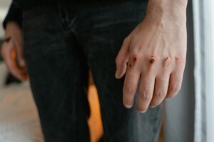 Wolno gojące się rany – przyczyny, diagnostyka i&nbsp;leczenie