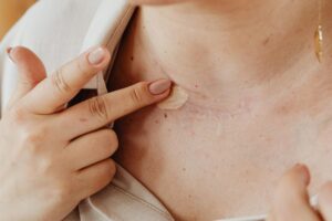 Zmiany skórne – rodzaje, przyczyny i&nbsp;diagnostyka