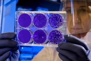 Czy&nbsp;antybiotyk działa na&nbsp;wirusy – fakty i&nbsp;mechanizmy działania